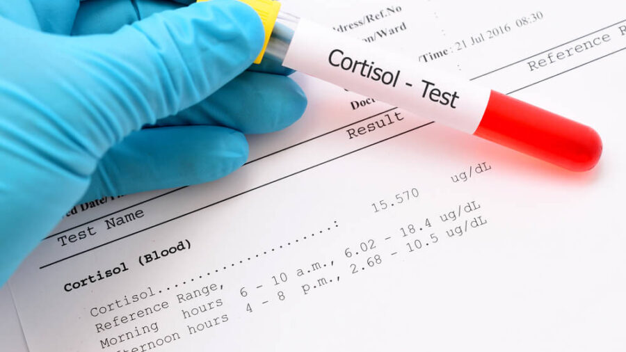 kortizol testi