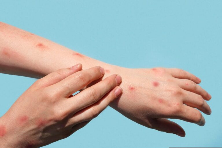 mvirus
