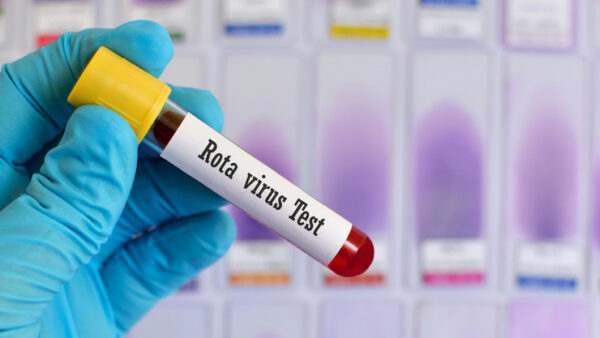 rotvairus test