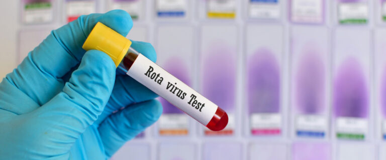 rotvairus test