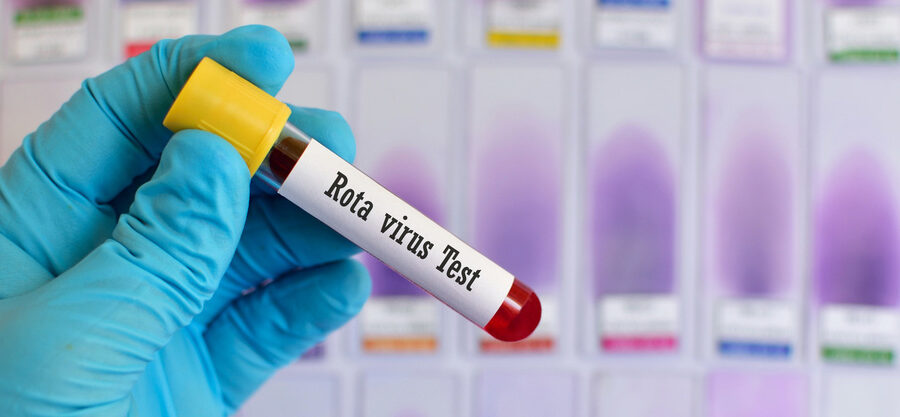 rotvairus test